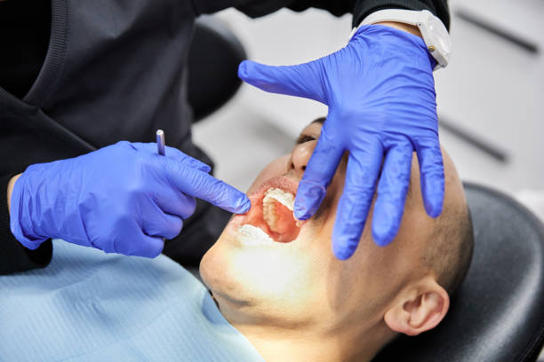 Best Emergency Root Canal Treatment in Saugatuck, CT