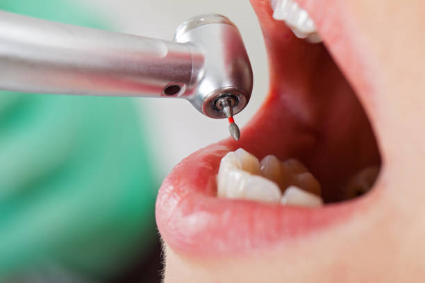 Best After-Hours Emergency Dentist in Saugatuck, CT